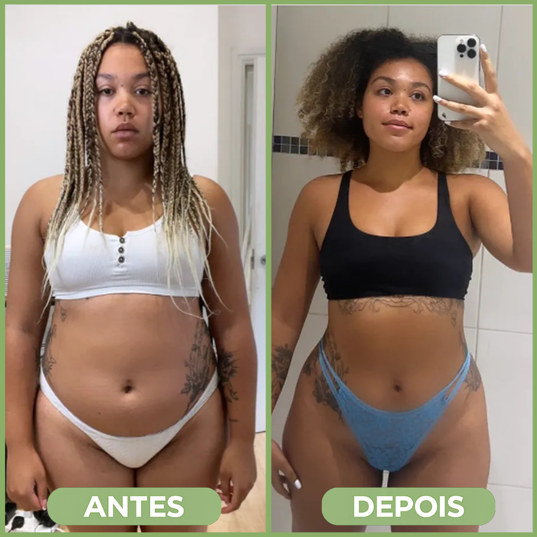 Before after minimal skincare Instagram post